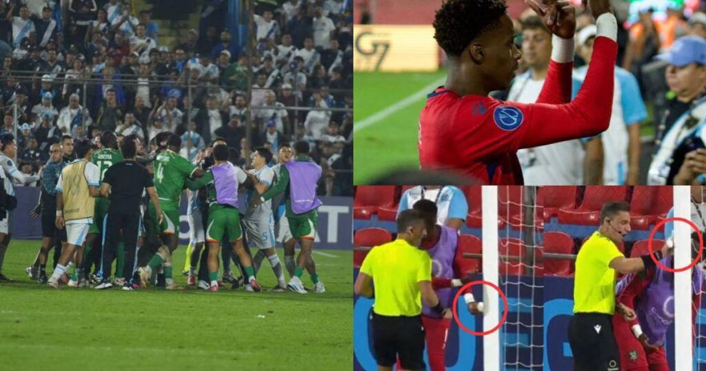 Concacaf: el castigo por polémicos gestos, racismo y la brujería que nadie esperó